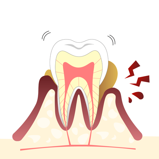 POINT 4 .虫歯や歯周病のリスクを軽減