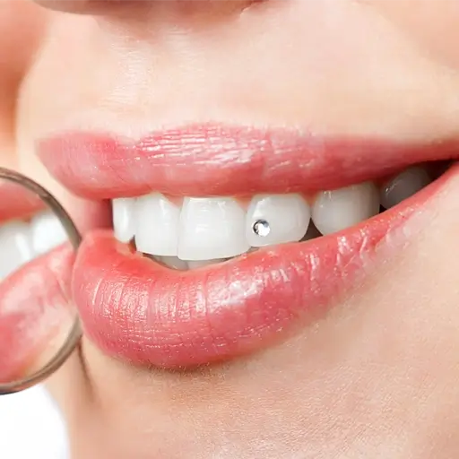 ティースジュエリーとは？